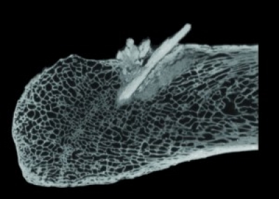 CT扫描显示Mastodon Bone上的嵌入式矛点